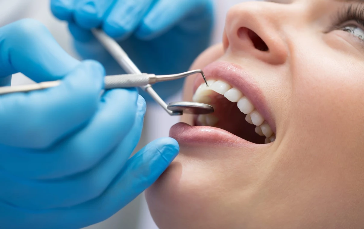 Les diastèmes en orthodontie : comprendre et traiter les espaces inter-dentaires